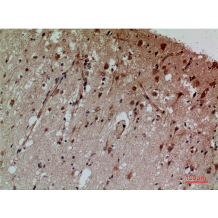 Immunohistochemistry - Anti-CD58 Antibody (C30368) - Antibodies.com