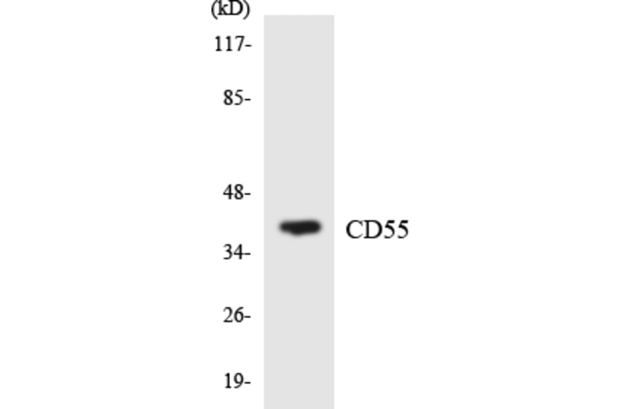 Western Blot - Anti-CD55 Antibody (R12-2589) - Antibodies.com