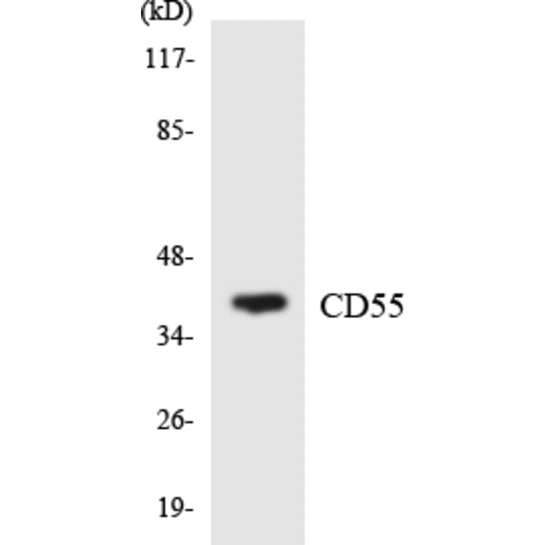 Western Blot - Anti-CD55 Antibody (R12-2589) - Antibodies.com