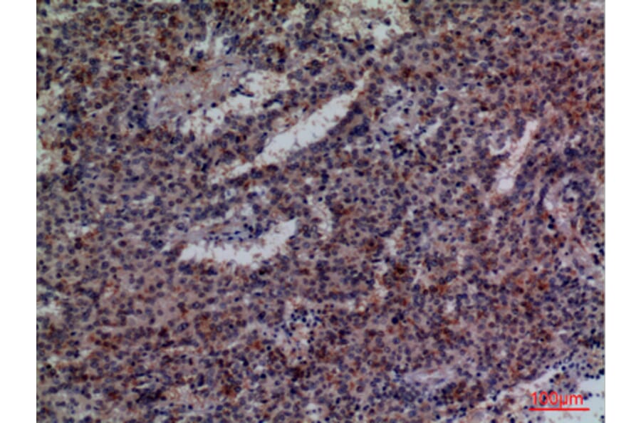 Immunohistochemistry - Anti-CD48 Antibody (C30357) - Antibodies.com
