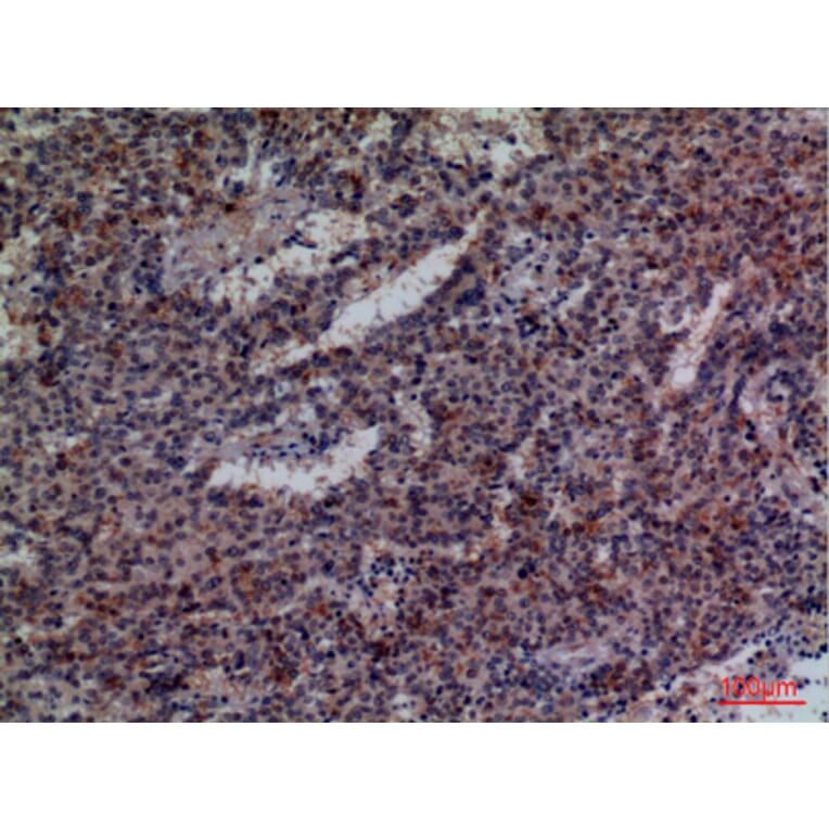 Immunohistochemistry - Anti-CD48 Antibody (C30357) - Antibodies.com