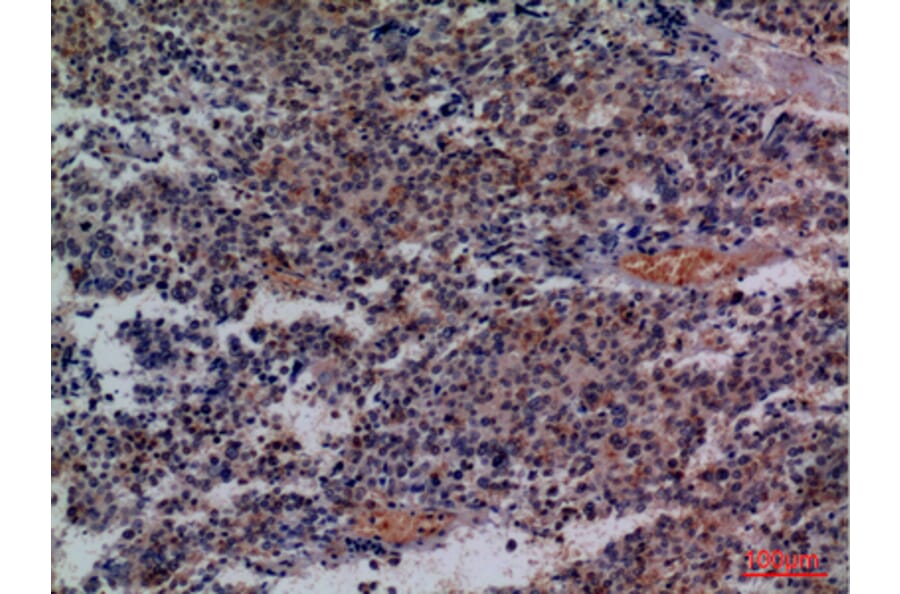 Immunohistochemistry - Anti-CD48 Antibody (C30357) - Antibodies.com