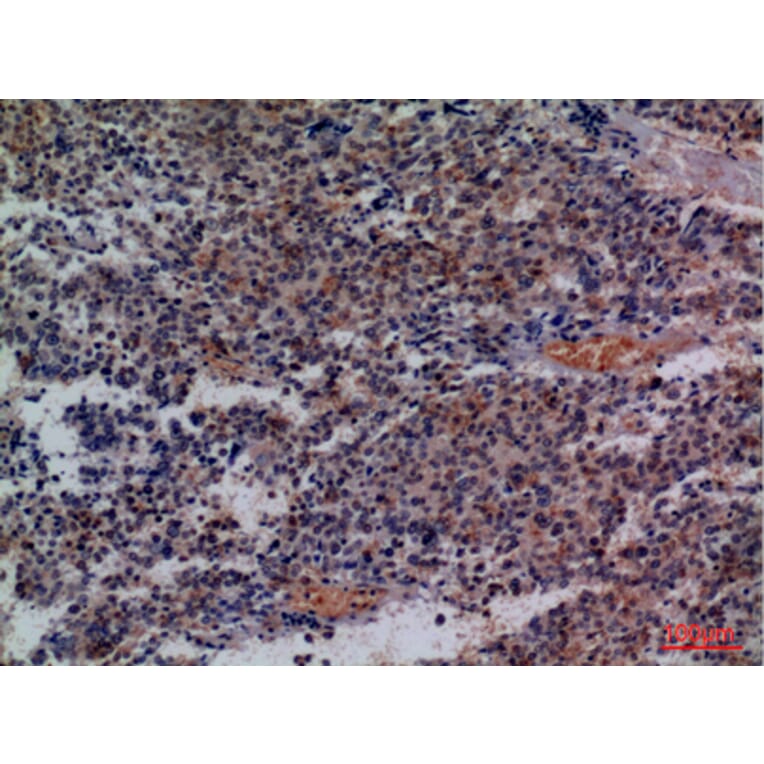 Immunohistochemistry - Anti-CD48 Antibody (C30357) - Antibodies.com