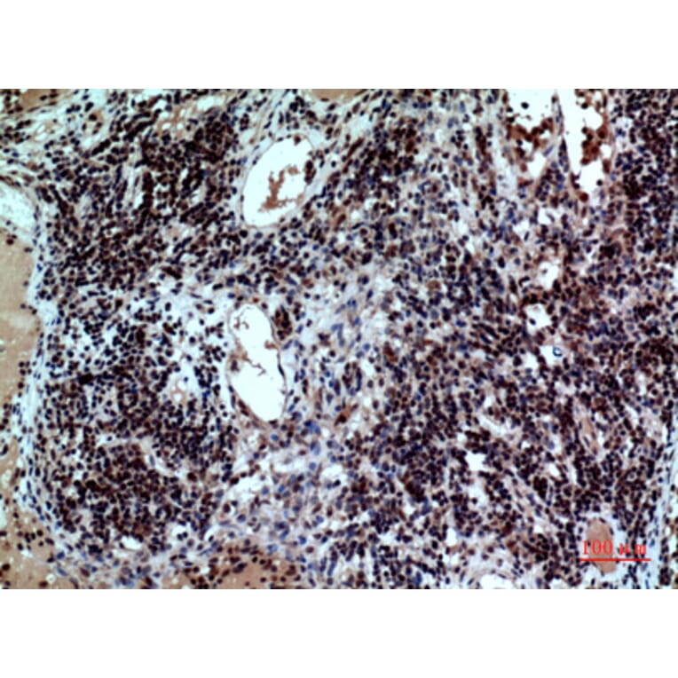 Immunohistochemistry - Anti-CD47 Antibody (C30356) - Antibodies.com