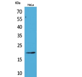 Western Blot - Anti-CD3D Antibody (C30320) - Antibodies.com