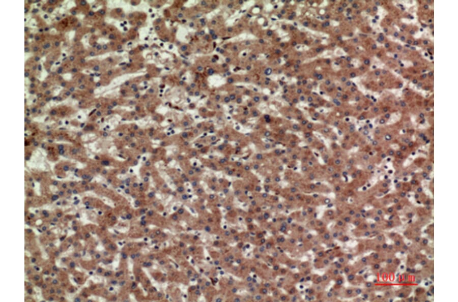 Immunohistochemistry - Anti-CD3D Antibody (C30320) - Antibodies.com