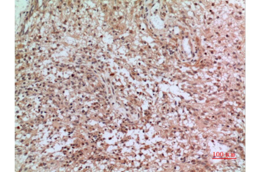 Immunohistochemistry - Anti-CD3D Antibody (C30320) - Antibodies.com