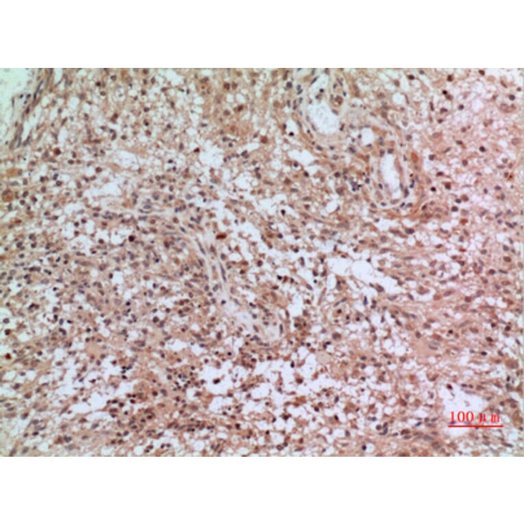 Immunohistochemistry - Anti-CD3D Antibody (C30320) - Antibodies.com