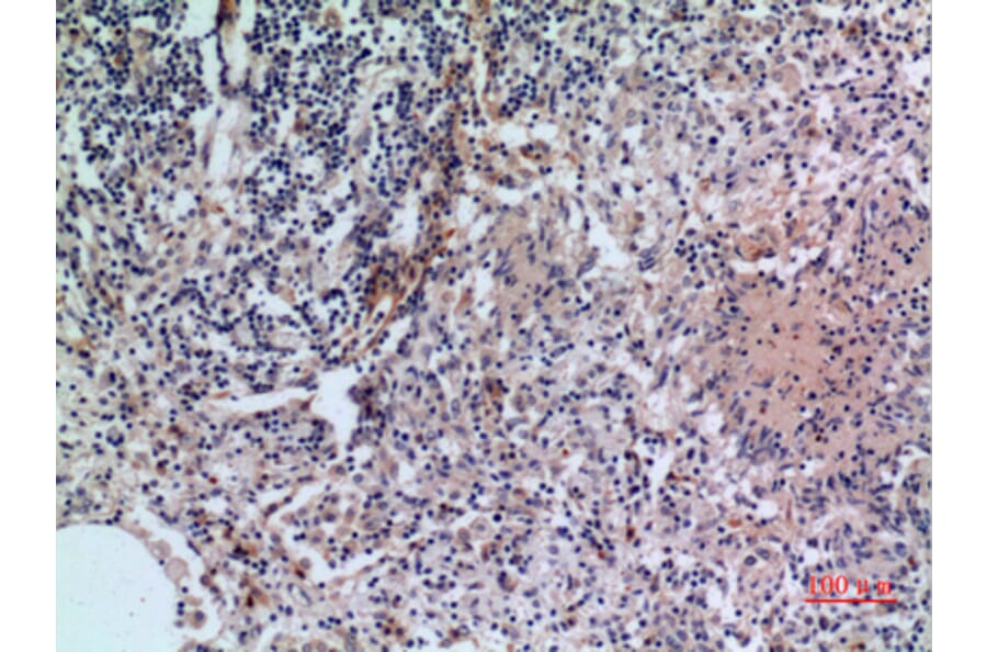 Immunohistochemistry - Anti-CD38 Antibody (C30348) - Antibodies.com