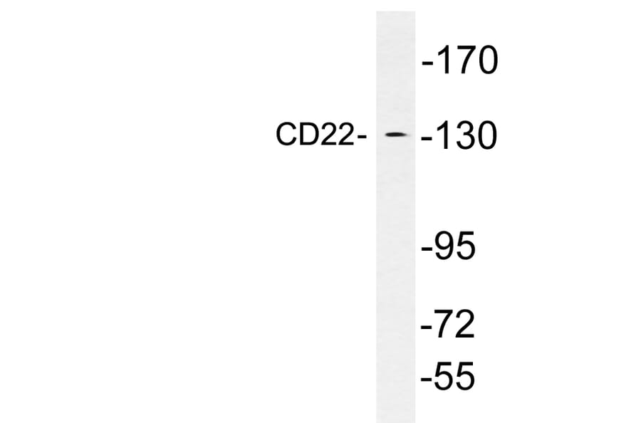 Western Blot - Anti-CD22 Antibody (R12-2069) - Antibodies.com