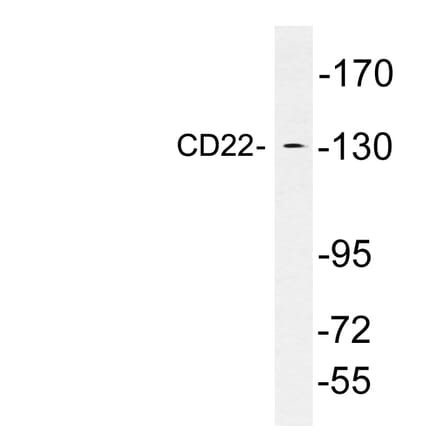 Western Blot - Anti-CD22 Antibody (R12-2069) - Antibodies.com
