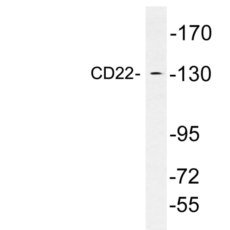 Western Blot - Anti-CD22 Antibody (R12-2069) - Antibodies.com