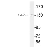 Western Blot - Anti-CD22 Antibody (R12-2069) - Antibodies.com
