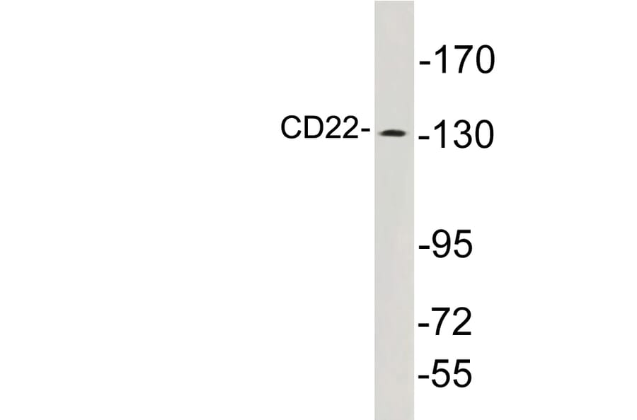 Western Blot - Anti-CD22 Antibody (R12-2070) - Antibodies.com