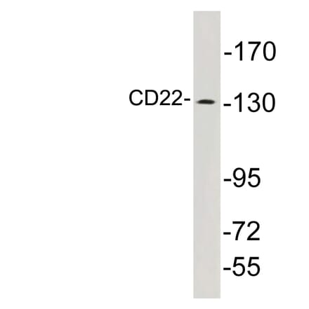 Western Blot - Anti-CD22 Antibody (R12-2070) - Antibodies.com