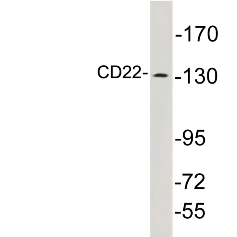 Western Blot - Anti-CD22 Antibody (R12-2070) - Antibodies.com