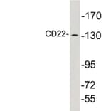 Western Blot - Anti-CD22 Antibody (R12-2070) - Antibodies.com