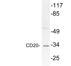 Western Blot - Anti-CD20 Antibody (R12-2067) - Antibodies.com