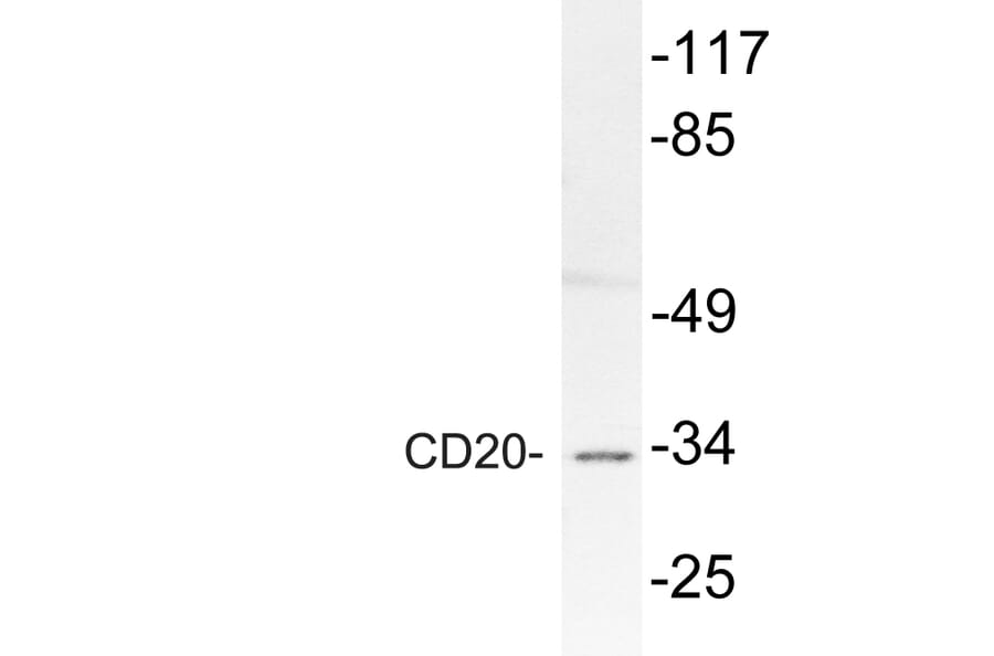 Western Blot - Anti-CD20 Antibody (R12-2067) - Antibodies.com