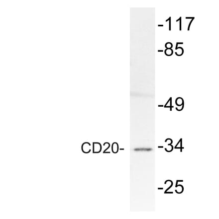 Western Blot - Anti-CD20 Antibody (R12-2067) - Antibodies.com