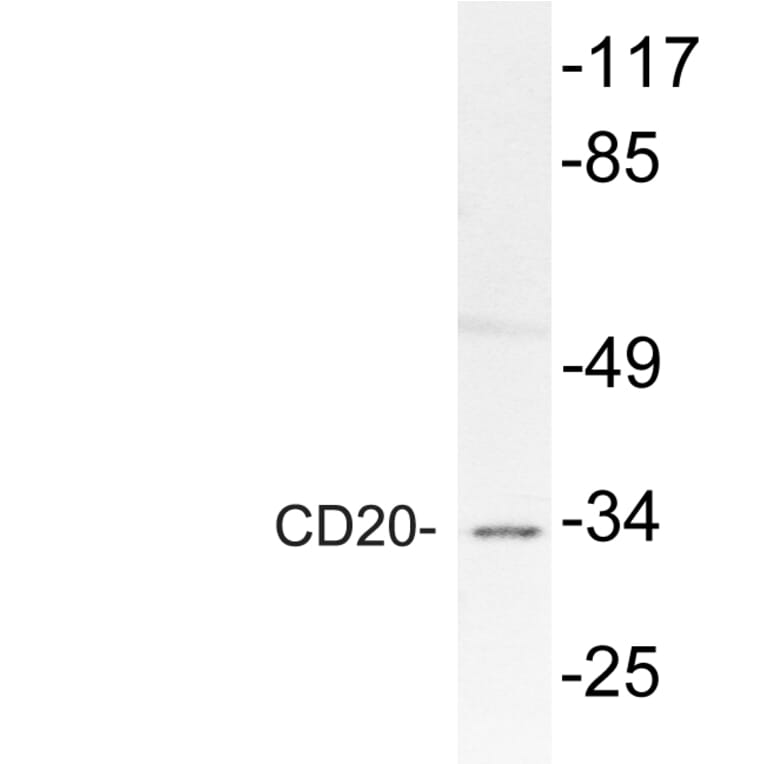 Western Blot - Anti-CD20 Antibody (R12-2067) - Antibodies.com