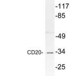 Western Blot - Anti-CD20 Antibody (R12-2067) - Antibodies.com