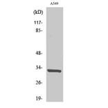 Western Blot - Anti-CD20 Antibody (R12-2067) - Antibodies.com