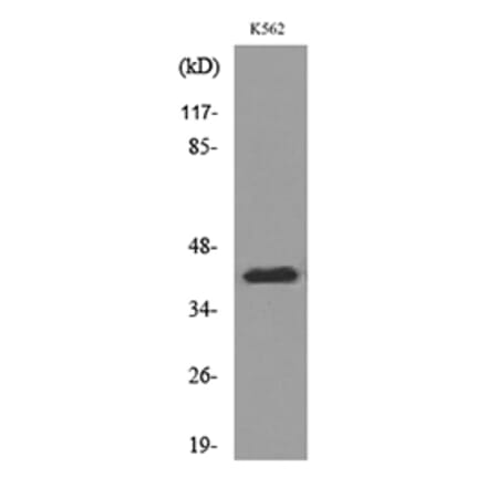 Western Blot - Anti-CD1E Antibody (C30318) - Antibodies.com