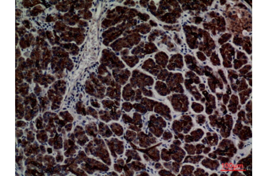 Immunohistochemistry - Anti-CD1E Antibody (C30318) - Antibodies.com