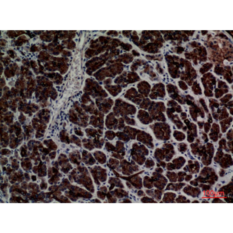Immunohistochemistry - Anti-CD1E Antibody (C30318) - Antibodies.com