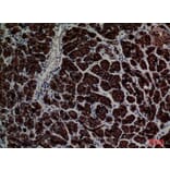 Immunohistochemistry - Anti-CD1E Antibody (C30318) - Antibodies.com