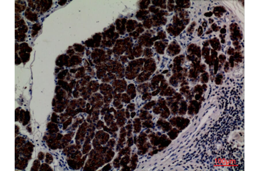 Immunohistochemistry - Anti-CD1E Antibody (C30318) - Antibodies.com