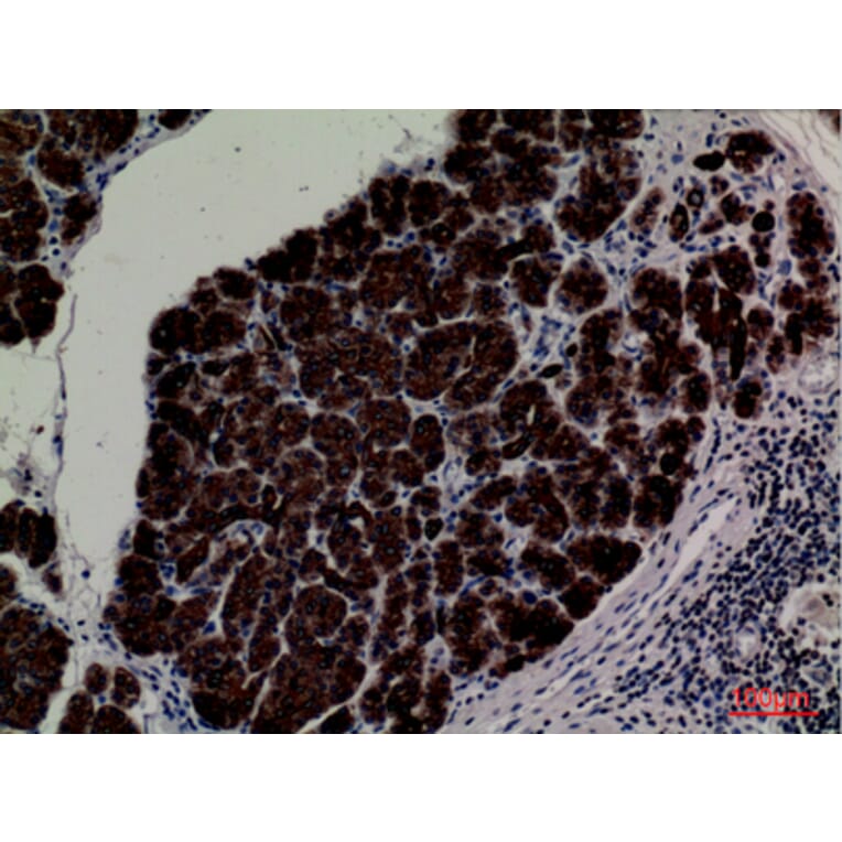 Immunohistochemistry - Anti-CD1E Antibody (C30318) - Antibodies.com