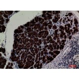 Immunohistochemistry - Anti-CD1E Antibody (C30318) - Antibodies.com