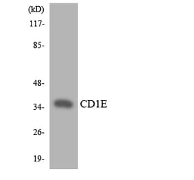 Western Blot - Anti-CD1E Antibody (R12-2585) - Antibodies.com