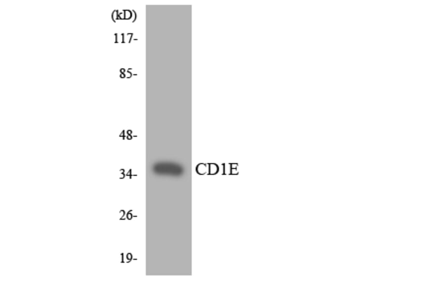 Western Blot - Anti-CD1E Antibody (R12-2585) - Antibodies.com