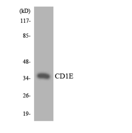 Western Blot - Anti-CD1E Antibody (R12-2585) - Antibodies.com