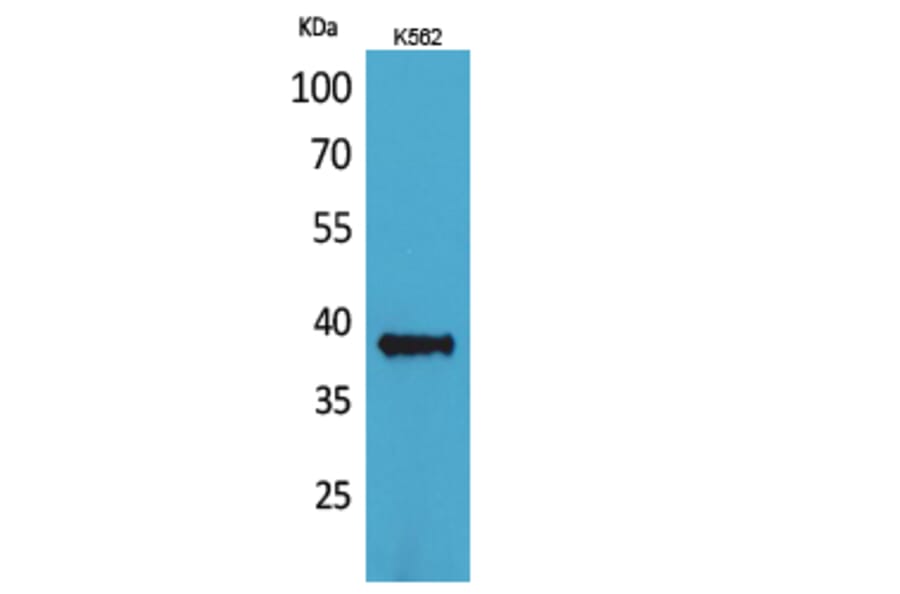 Western Blot - Anti-CD1C Antibody (C30316) - Antibodies.com