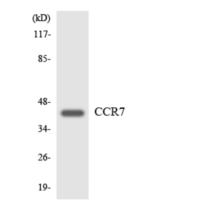 Western Blot - Anti-CCR7 Antibody (R12-2578) - Antibodies.com