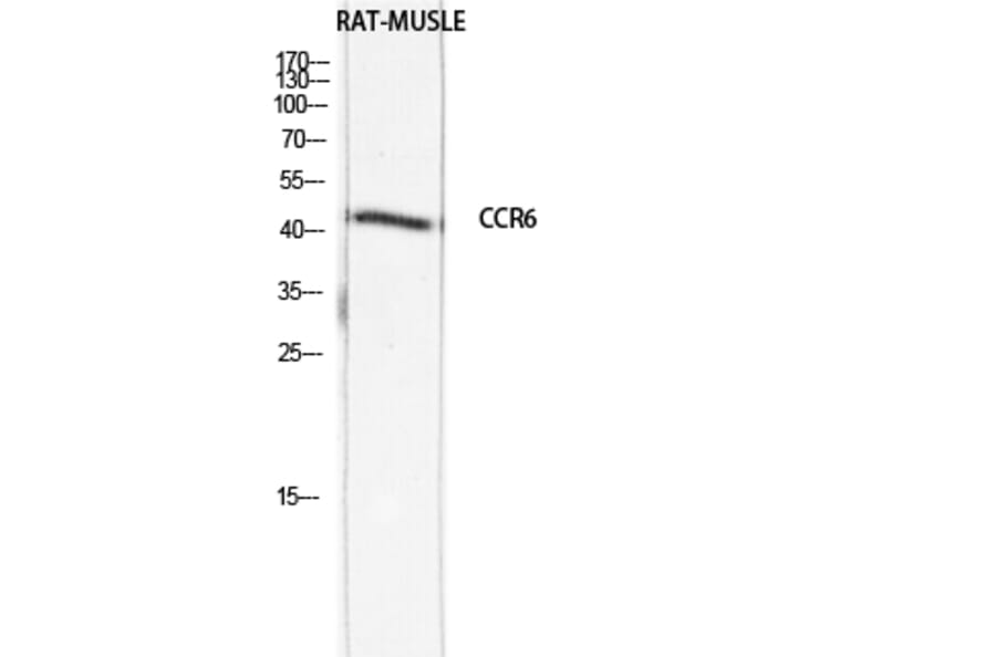 Western Blot - Anti-CCR6 Antibody (C30470) - Antibodies.com
