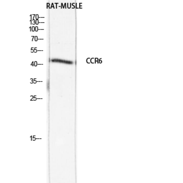 Western Blot - Anti-CCR6 Antibody (C30470) - Antibodies.com