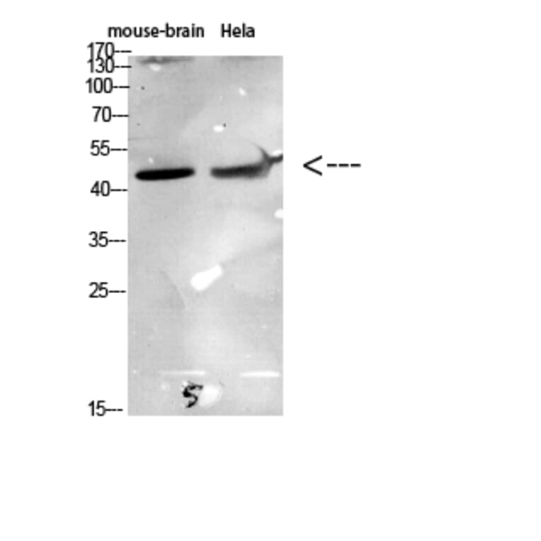 Western Blot - Anti-CCR6 Antibody (C30470) - Antibodies.com