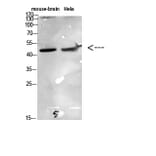 Western Blot - Anti-CCR6 Antibody (C30470) - Antibodies.com