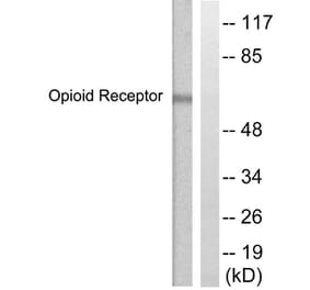 Western Blot - Anti-CCR5 Antibody (B0062) - Antibodies.com