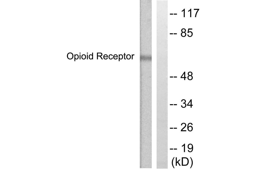 Western Blot - Anti-CCR5 Antibody (B0062) - Antibodies.com