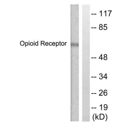 Western Blot - Anti-CCR5 Antibody (B0062) - Antibodies.com