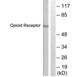 Western Blot - Anti-CCR5 Antibody (B0062) - Antibodies.com