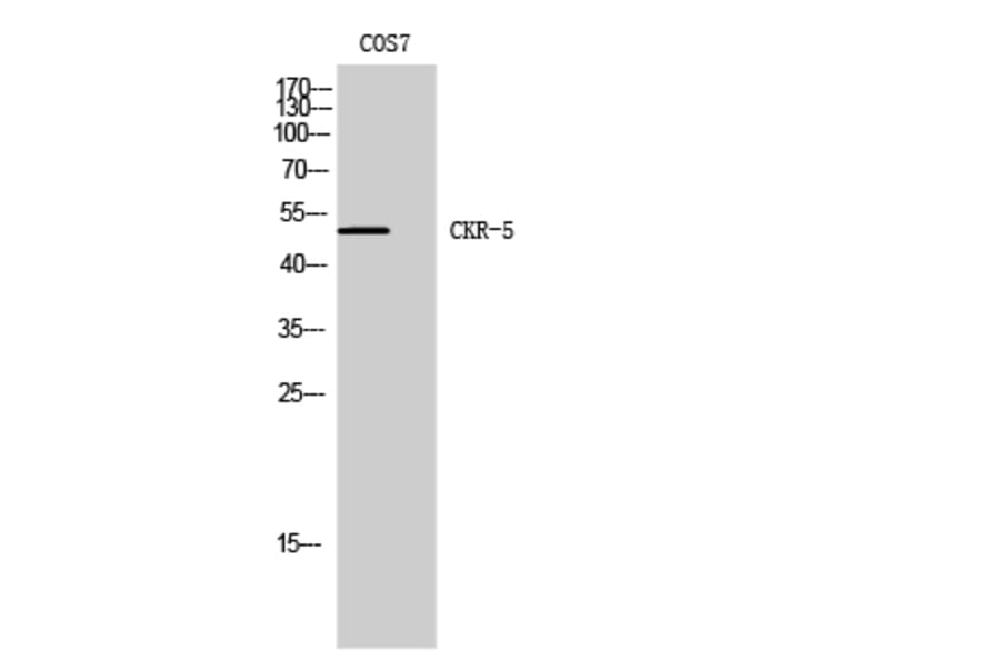 Western Blot - Anti-CCR5 Antibody (B0062) - Antibodies.com
