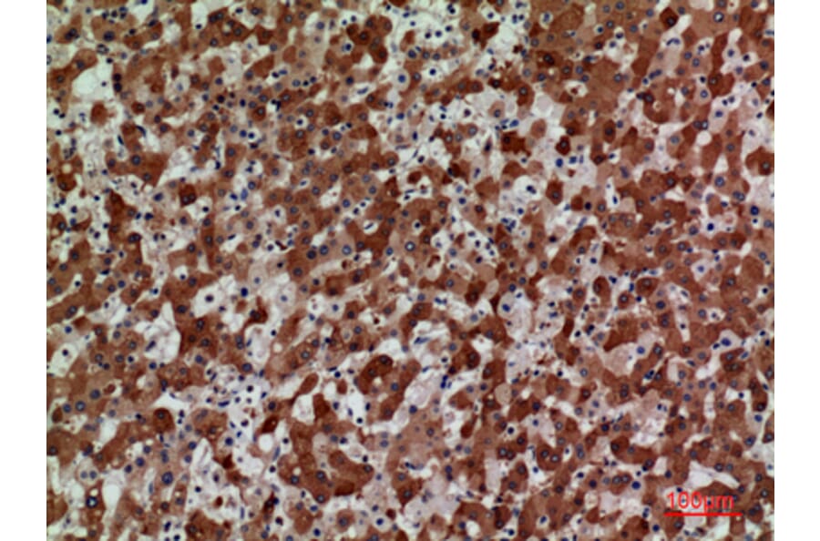 Immunohistochemistry - Anti-CCR3 Antibody (C30578) - Antibodies.com