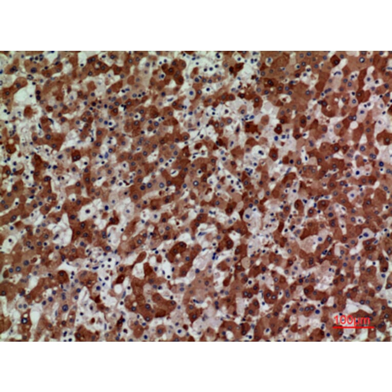 Immunohistochemistry - Anti-CCR3 Antibody (C30578) - Antibodies.com
